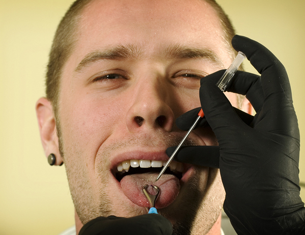 What dentists think about tongue piercing
